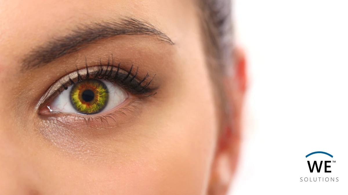 Close-up of an open eye representing scleral lens wear.